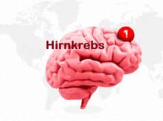 Antidepressivum Vortioxetin zeigt vielversprechende Ergebnisse bei Behandlung von Hirntumor