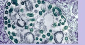 Marburg-Virus: Tödlicher Ausbruch in Ruanda und weltweite Bemühungen zur Impfstoffen