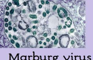 Marburg-Virus: Tödlicher Ausbruch in Ruanda und weltweite Bemühungen zur Impfstoffen