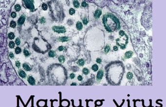 Marburg-Virus: Tödlicher Ausbruch in Ruanda und weltweite Bemühungen zur Impfstoffen