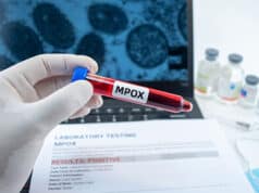 Erster Fall von Clade 1b Mpox in Großbritannien: Risiken, Schutzmaßnahmen und internationale Perspektiven