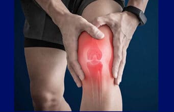 Innovative Lösungen für Kniearthrose und Meniskusschäden Algen und 3D-Implantate revolutionieren die Medizin