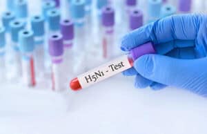 H5N1 Vogelgrippe: Risiken, Symptome und Schutzmaßnahmen im Überblick