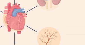 Schlaganfall-Risiken, Symptome und Prävention: Alles, was Sie wissen müssen