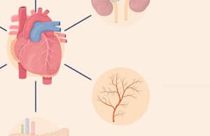 Schlaganfall-Risiken, Symptome und Prävention: Alles, was Sie wissen müssen