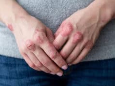 Trockene Haut im Winter: Ursachen, Tipps und die beste Pflege für gesunde Haut