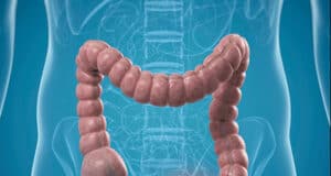 Wie Sie Darmkrebs effektiv vorbeugen: Tipps zur Früherkennung und gesunden Lebensweise